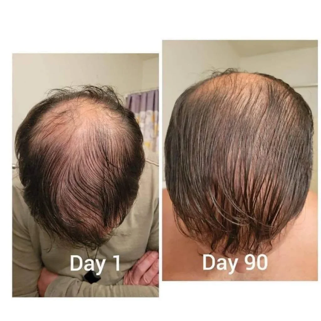 Doorbreek de mythes: Echte feiten in deze Liquid Collagen Review 19 vloeibare collageen resultaten 5