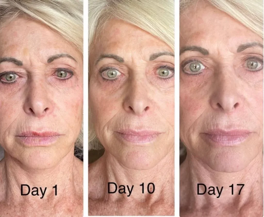 Doorbreek de mythes: Echte feiten in deze Liquid Collagen Review 13 vloeibare collageen resultaten 7