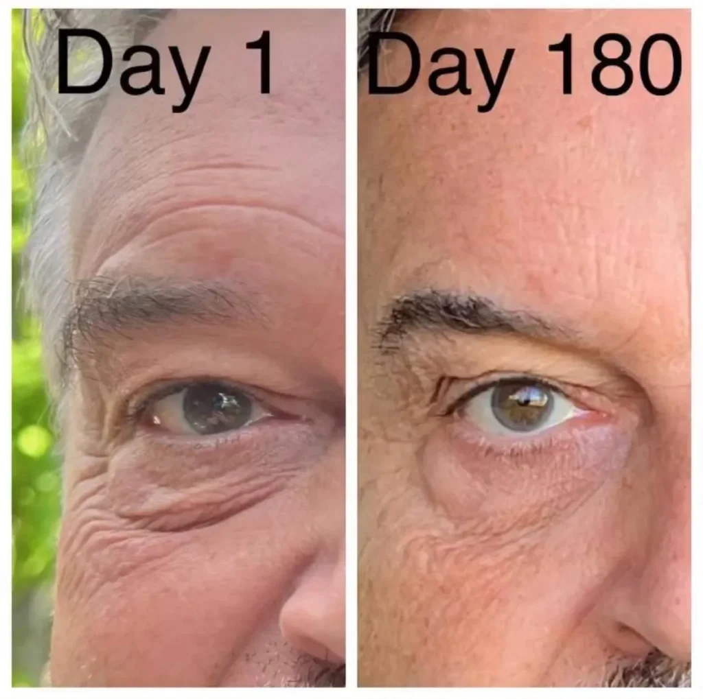 Doorbreek de mythes: Echte feiten in deze Liquid Collagen Review 21 vloeibare collageen resultaten 8