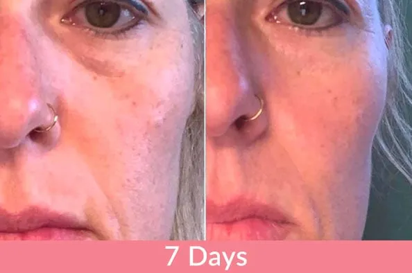 Doorbreek de mythes: Echte feiten in deze Liquid Collagen Review 7 vloeibare collageen resultaten03