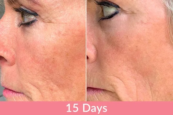 Doorbreek de mythes: Echte feiten in deze Liquid Collagen Review 8 vloeibare collageenresultaten04