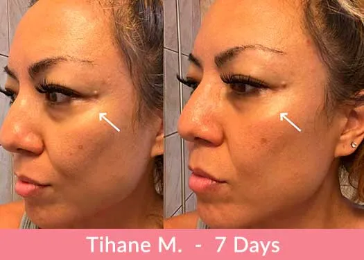 Doorbreek de mythes: Echte feiten in deze Liquid Collagen Review 6 tihani m 7 dagen