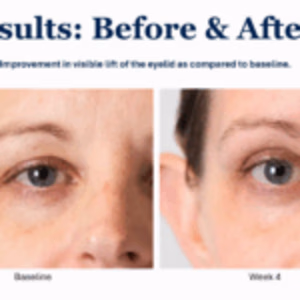 Before After Results Truescience Activated Skin Care Collection | Nutrigenomics Store 6 TrueScience Activated Skin Care Collection results