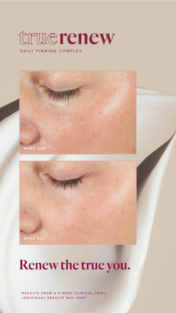 Reclaim Your Radiance With True Renew: The Best Wrinkle Remover For Face 15 LFVN US True Renew BA Social US 01