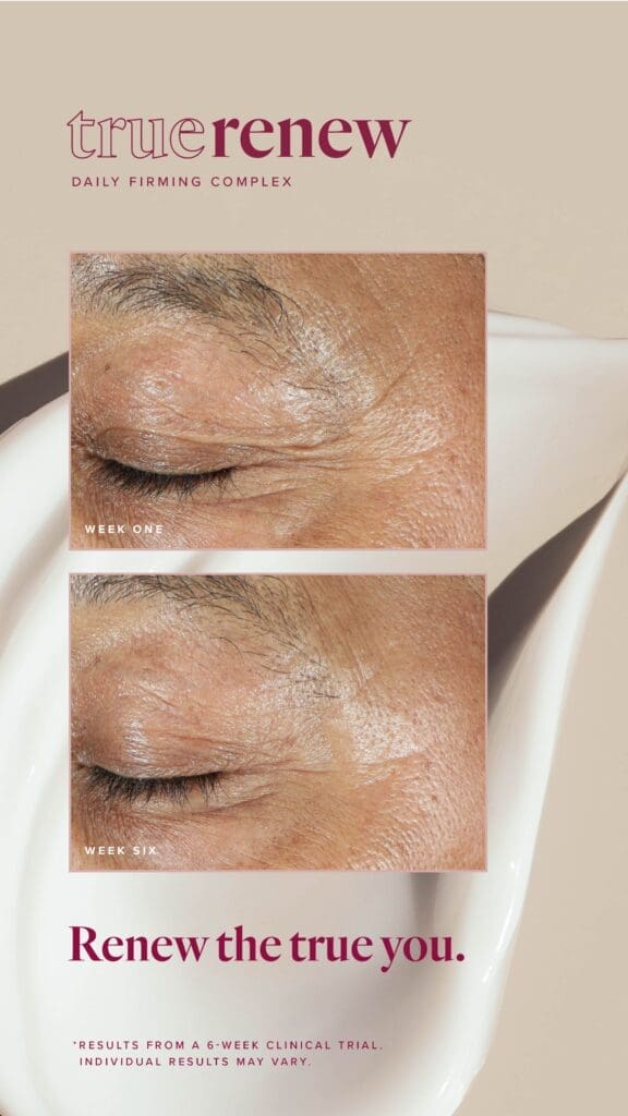 Reclaim Your Radiance With True Renew: The Best Wrinkle Remover For Face 14 LFVN US True Renew BA Social US 02