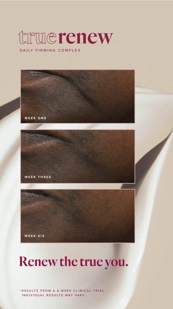 Reclaim Your Radiance With True Renew: The Best Wrinkle Remover For Face 13 LFVN US True Renew BA Social US 03
