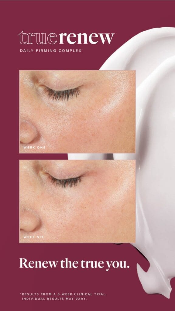 Reclaim Your Radiance With True Renew: The Best Wrinkle Remover For Face 12 LFVN US True Renew BA Social US 04