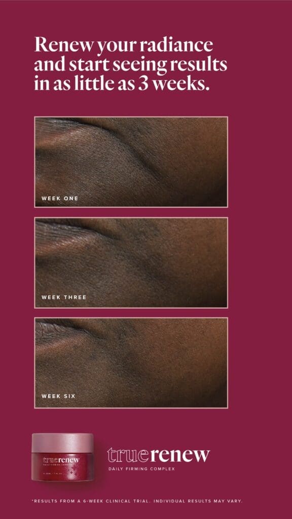 Reclaim Your Radiance With True Renew: The Best Wrinkle Remover For Face 10 LFVN US True Renew BA Social US 06
