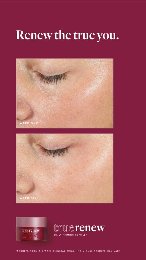 Reclaim Your Radiance With True Renew: The Best Wrinkle Remover For Face 9 LFVN US True Renew BA Social US 07
