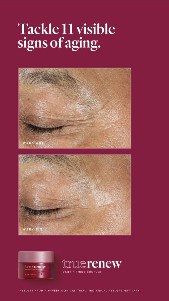 Reclaim Your Radiance With True Renew: The Best Wrinkle Remover For Face 8 LFVN US True Renew BA Social US 08