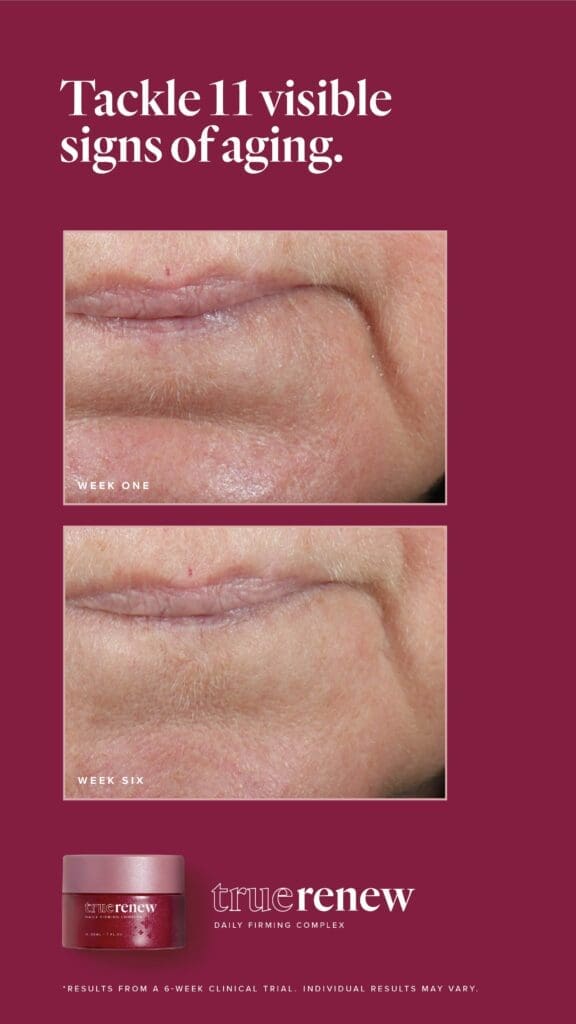 Reclaim Your Radiance With True Renew: The Best Wrinkle Remover For Face 6 LFVN US True Renew BA Social US 11