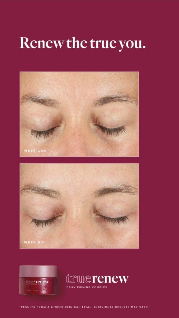 Reclaim Your Radiance With True Renew: The Best Wrinkle Remover For Face 5 LFVN US True Renew BA Social US 12