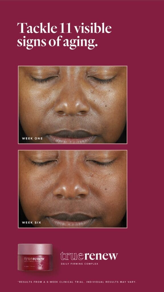 Reclaim Your Radiance With True Renew: The Best Wrinkle Remover For Face 4 LFVN US True Renew BA Social US 13