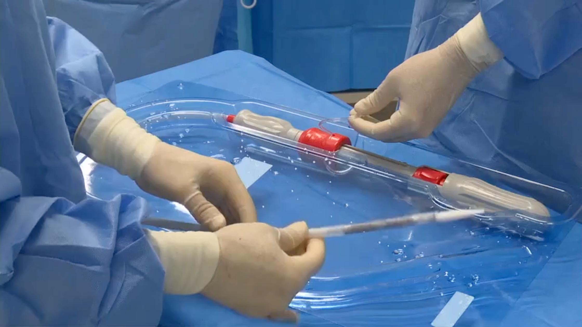 photo of physician hands using P&F TricValveรยฎ Transcatheter Bicaval Valves System