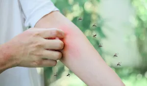 Person scratching red, irritated forearm with several mosquitoes flying nearby