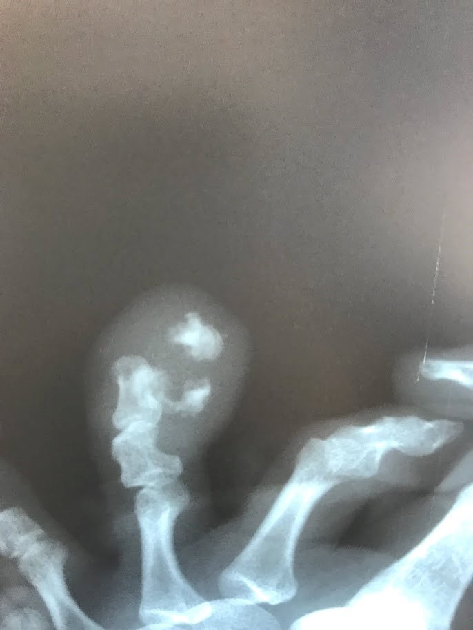 X-ray showing head, neck, and upper spine for chiropractic evaluation.