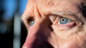 New Treatments in Age-Related Macular Degeneration