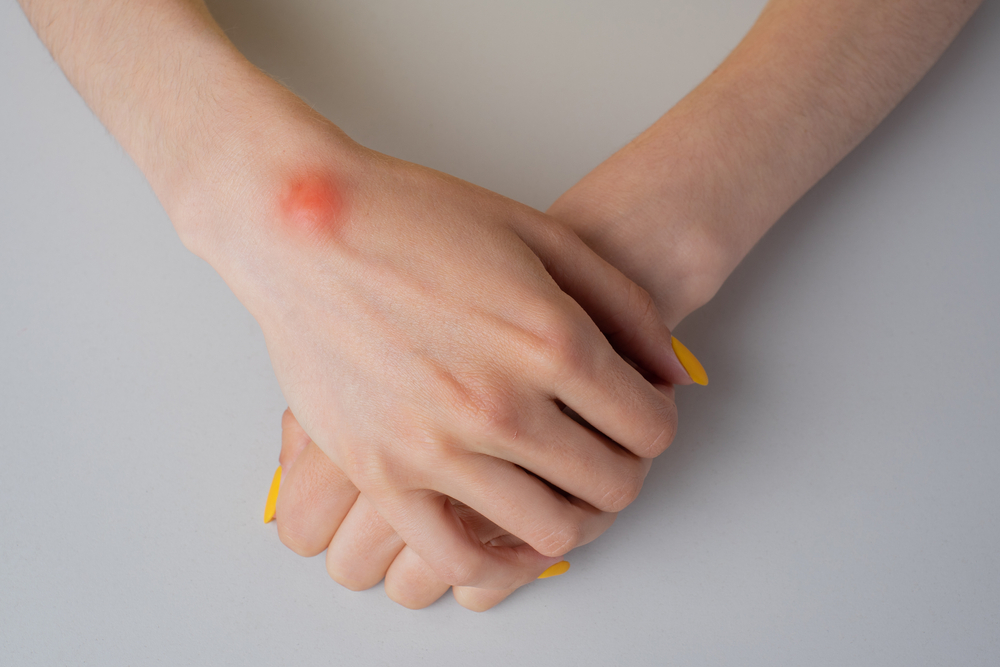 Microkyste Microkyste : les meilleurs solutions naturelles pour en venir à bout ...