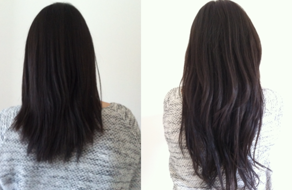 avant apres extensions