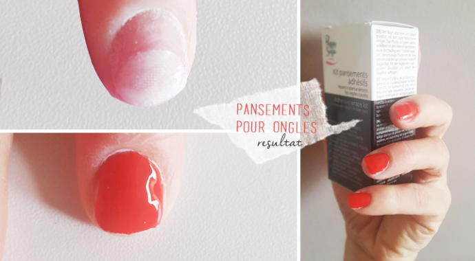 réparer un ongle cassé