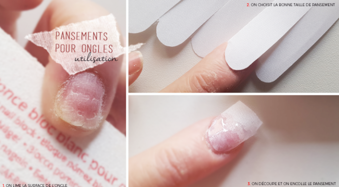 pansement pour ongles