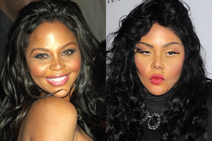 lil-kim http-::fr.celebrity.red:buzz:stars-ravagees-par-la-chirurgie-esthetique:2
