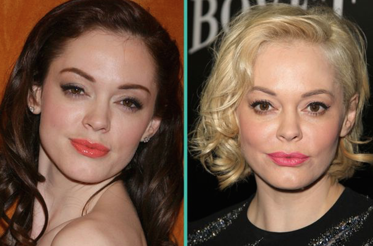 rose-mcgowan http-::www.w12.fr:rose-mcgowan-chirurgie-esthetique-ratee