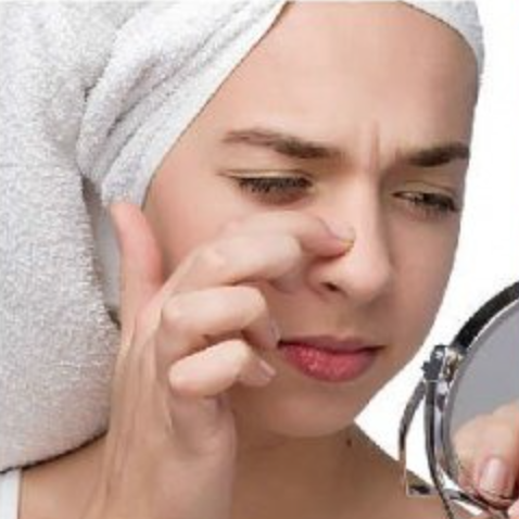 15 astuces pour vous débarrasser des points noirs !