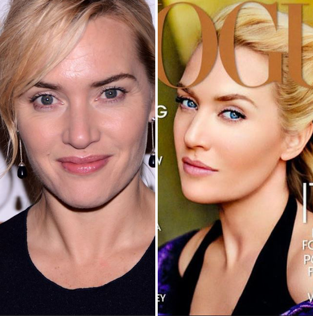 STARS : Finalement sans photoshop elles sont comme nous