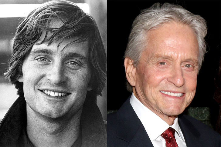 michael-douglas-dents