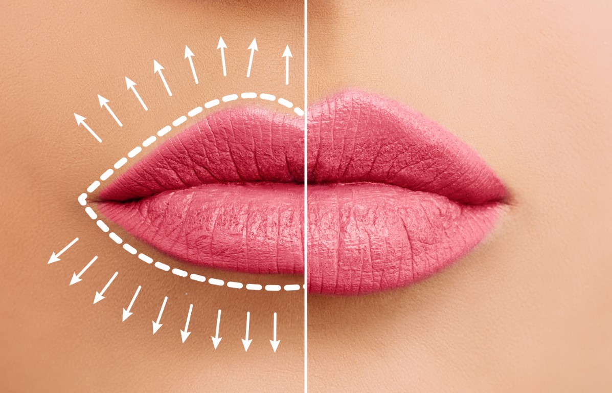 Avant/après des lèvres pulpeuses avec maquillage