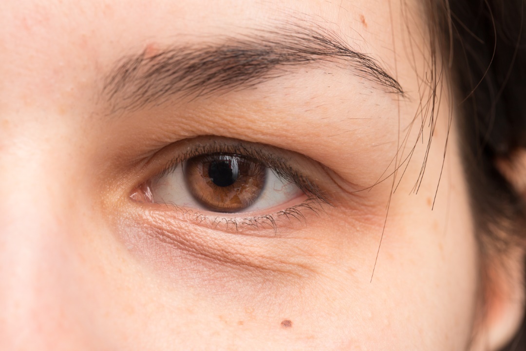 regard fatigué