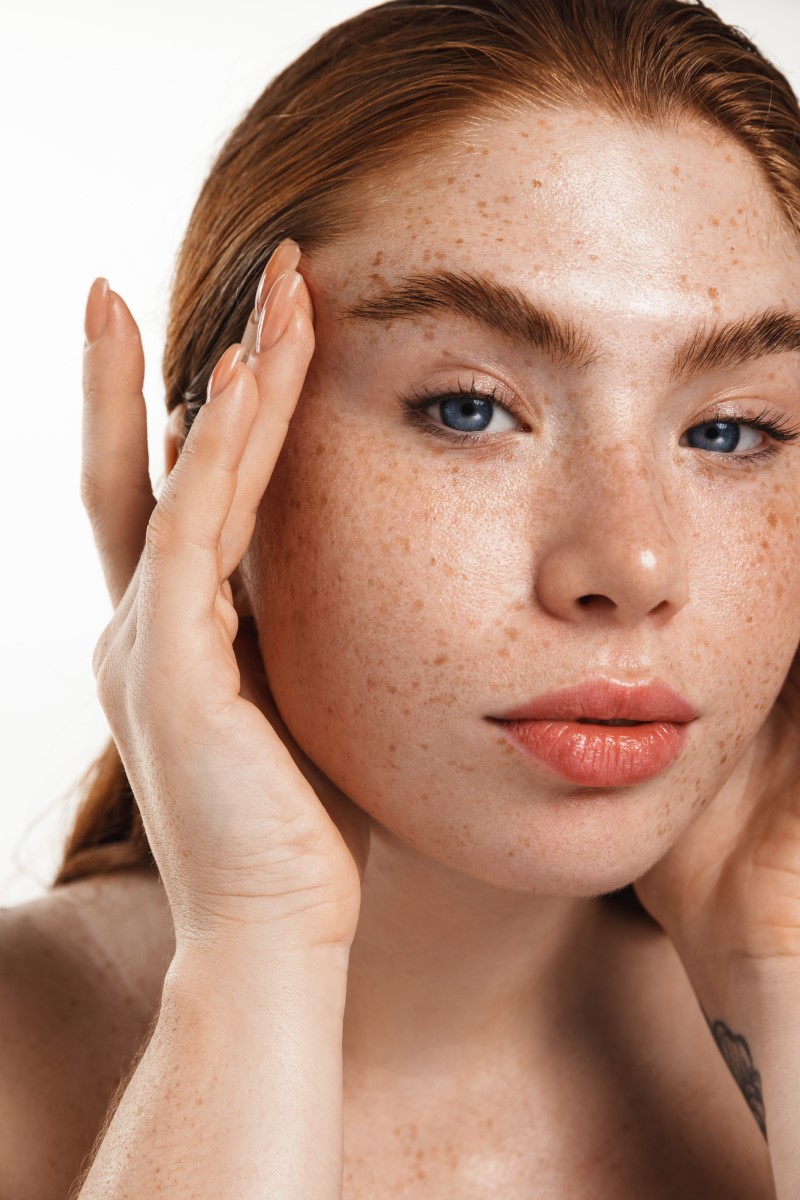 brow lift