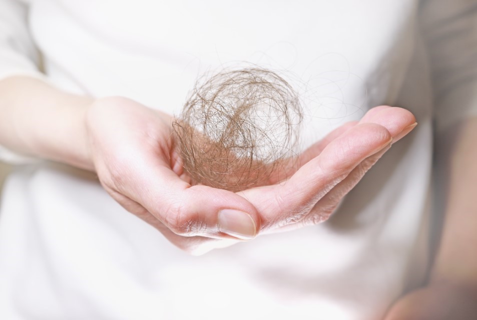 perte cheveux femme causes