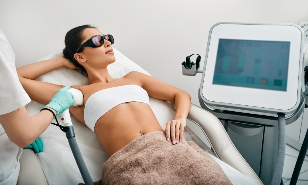 épilation laser bras