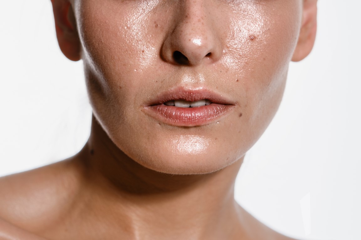 femme qui a la peau grasse
