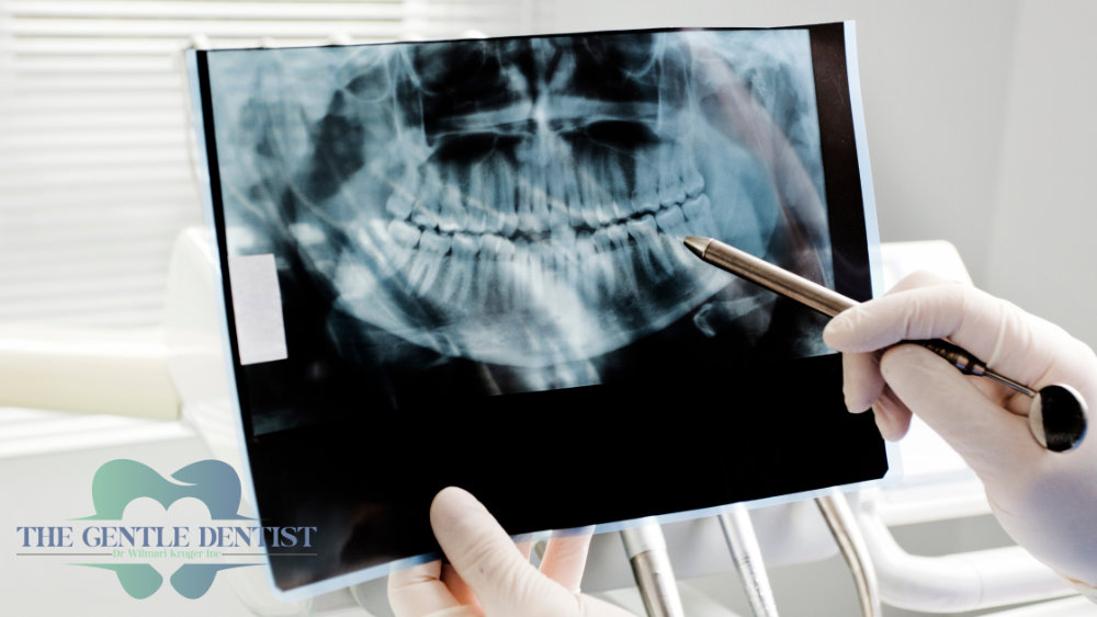 Dantal x-rays header An X-ray of the mouth and teeth at a dental office.