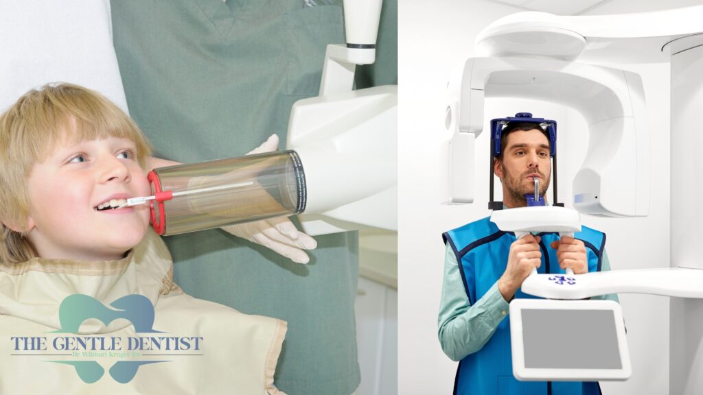 What Dental X-Rays Reveal That You Can’t See in the Mirror (But Need to Know) 1 An example of a peripheral and bitewing x-ray.