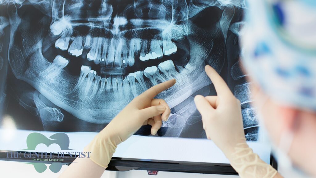 What Dental X-Rays Reveal That You Can’t See in the Mirror (But Need to Know) 3 An X-ray of the mouth and teeth at a dental office.