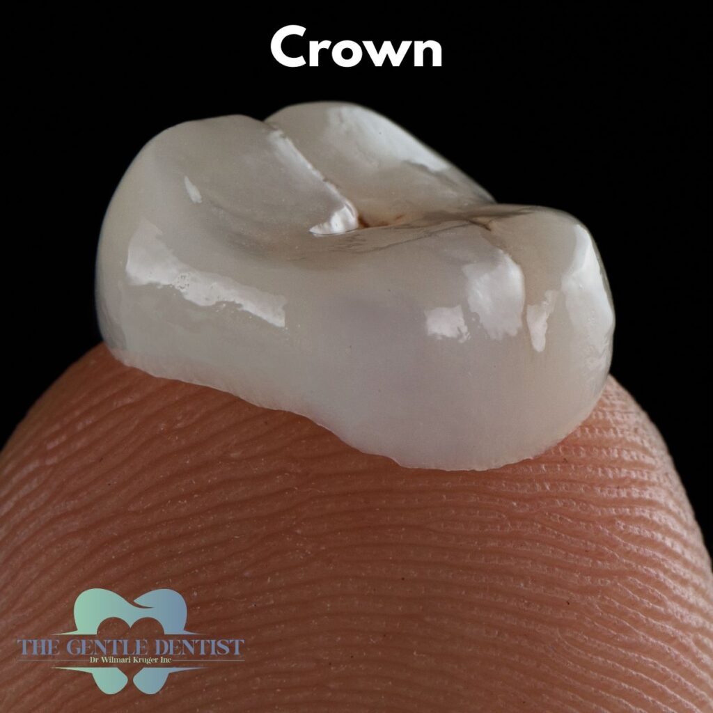 Filling or Crown: How Dentists Decide (and What It Means for You) 3 Dental crown close-up on fingertip at The Gentle Dentist, Centurion – porcelain crown shape and detail.