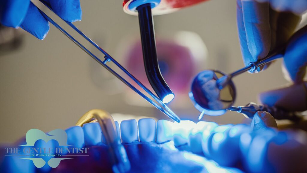 Filling or Crown: How Dentists Decide (and What It Means for You) 4 The Gentle Dentist in Centurion using blue curing light during filling treatment on front teeth.