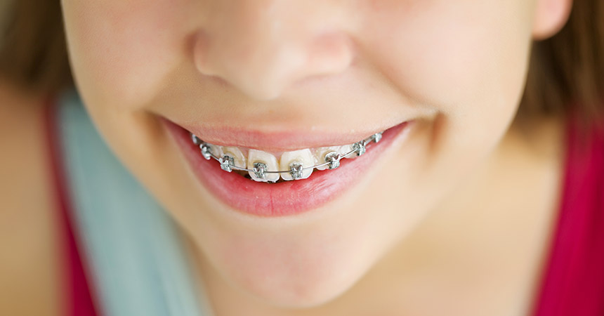 paediatric-orthodontics
