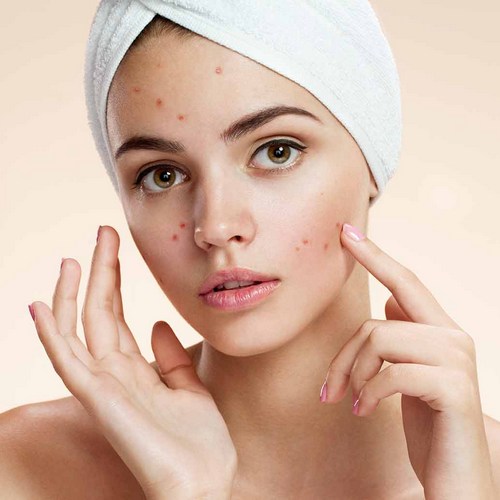 Roaccutane