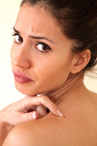 acne dos epaules