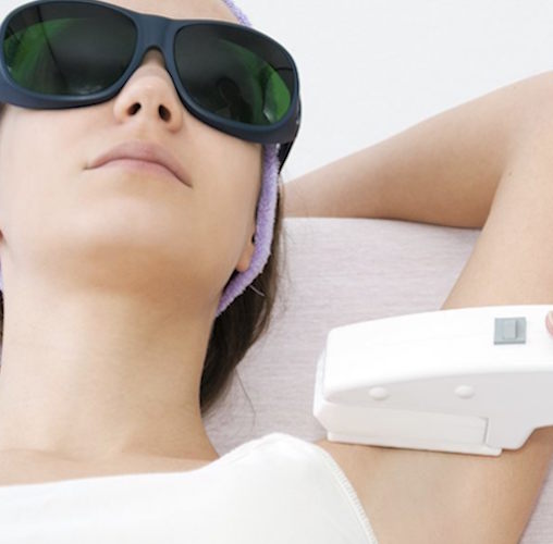 Vous en pensez quoi de l'épilation au laser ?
